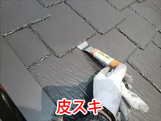 皮スキによる縁切り