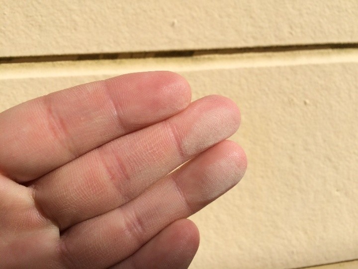 外壁にはチョーキングが発生